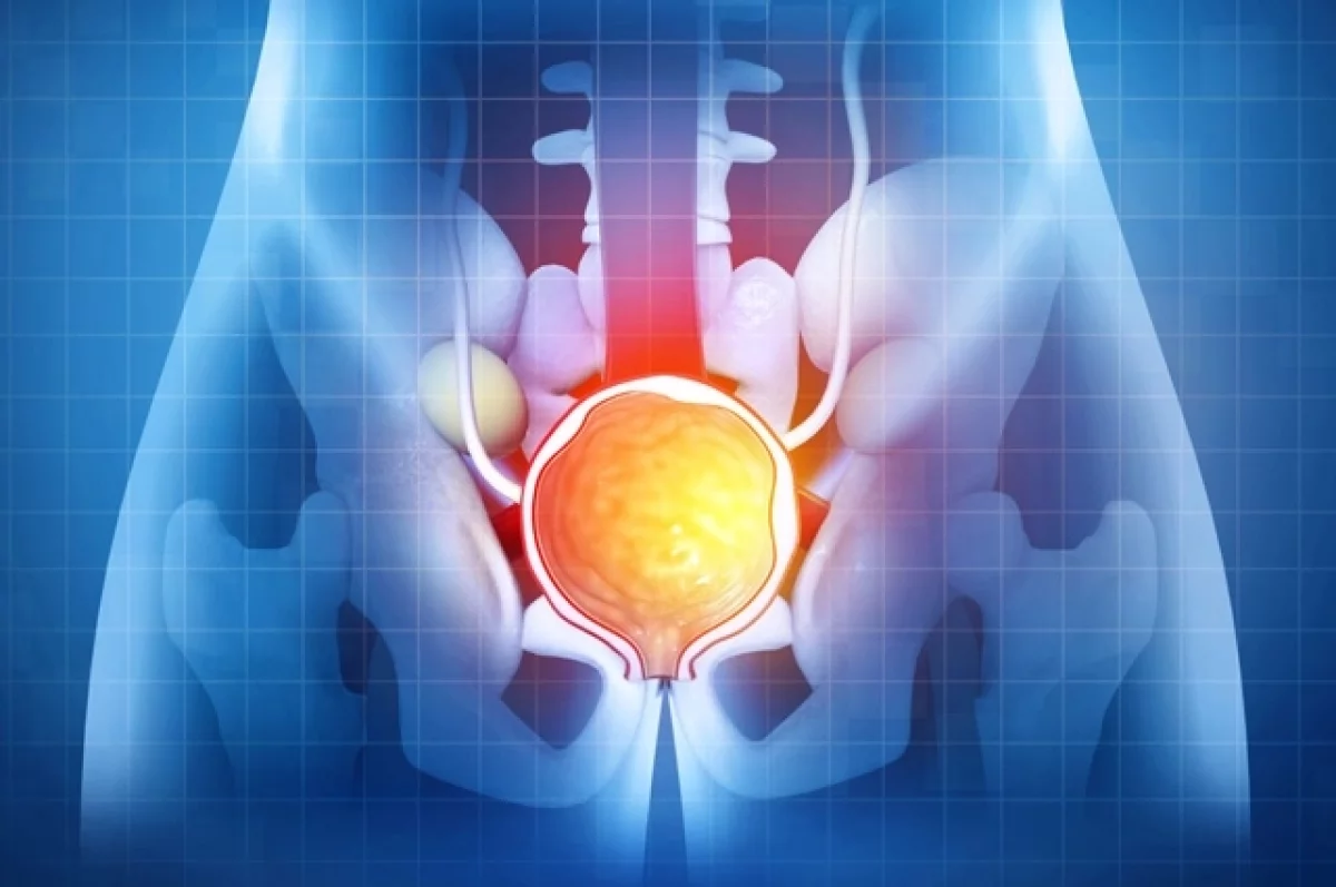 Опухоль или воспаление простаты? У маленькой железы бывают большие проблемы